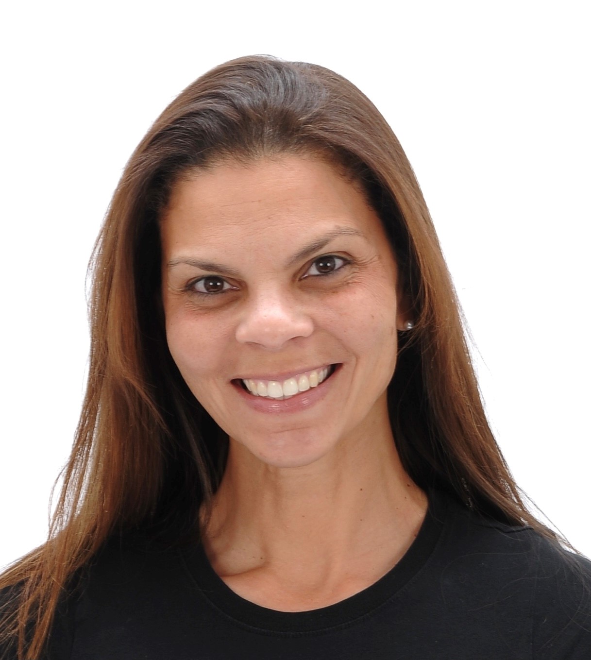 Tia Torres Teeth Transformation: Before & After - 54c1alx